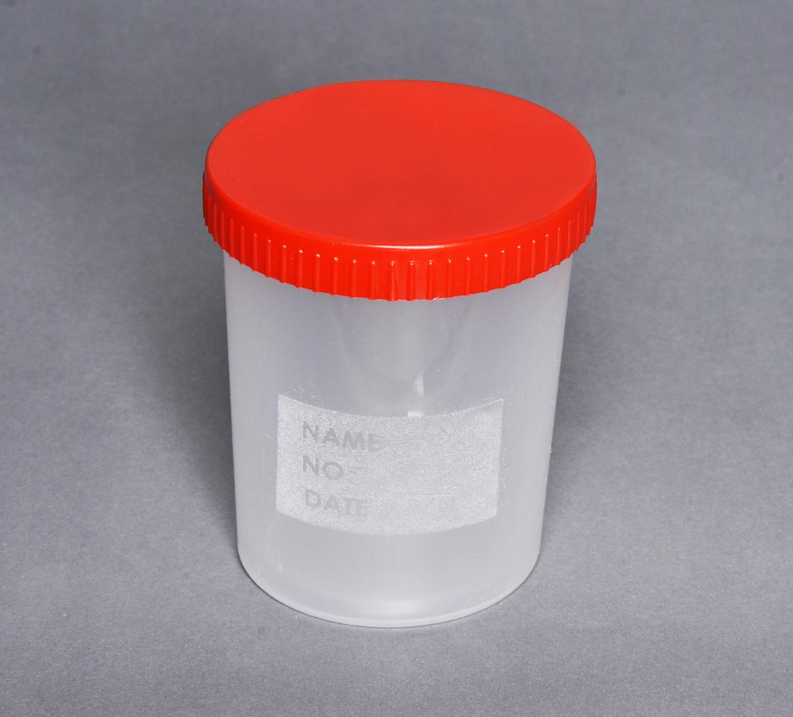 250 ML NUMUNE KABI
